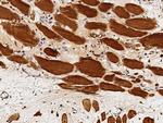 GSTM2 Antibody in Immunohistochemistry (Paraffin) (IHC (P))