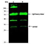 GSTM2 Antibody in Immunoprecipitation (IP)