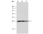 GSTP1 Antibody in Western Blot (WB)