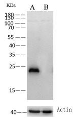 GSTP1 Antibody in Western Blot (WB)