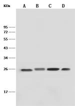 GSTP1 Antibody in Western Blot (WB)