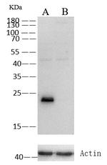 GSTP1 Antibody in Western Blot (WB)