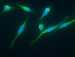 ITCH Antibody in Immunocytochemistry (ICC/IF)