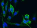 CD171 Antibody in Immunocytochemistry (ICC/IF)