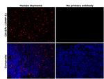 LAMP1 Antibody in Immunohistochemistry (Paraffin) (IHC (P))