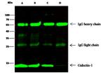 Galectin 1 Antibody in Immunoprecipitation (IP)