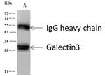 Galectin 3 Antibody in Immunoprecipitation (IP)