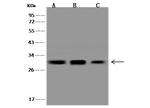 Galectin 3 Antibody in Western Blot (WB)