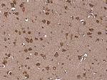 RAP Antibody in Immunohistochemistry (Paraffin) (IHC (P))