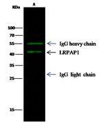 RAP Antibody in Immunoprecipitation (IP)