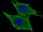 LTA4H Antibody in Immunocytochemistry (ICC/IF)