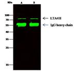 LTA4H Antibody in Immunoprecipitation (IP)