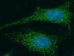 LUM Antibody in Immunocytochemistry (ICC/IF)