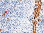 CD146 Antibody in Immunohistochemistry (Paraffin) (IHC (P))