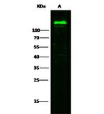 CD146 Antibody in Western Blot (WB)