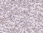 MSH6 Antibody in Immunohistochemistry (Paraffin) (IHC (P))