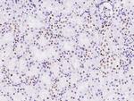 MSH6 Antibody in Immunohistochemistry (Paraffin) (IHC (P))