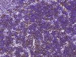 MSH6 Antibody in Immunohistochemistry (Paraffin) (IHC (P))