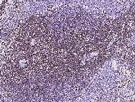 MSH6 Antibody in Immunohistochemistry (Paraffin) (IHC (P))