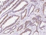 MSH6 Antibody in Immunohistochemistry (Paraffin) (IHC (P))