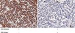 NBL1 Antibody in Immunohistochemistry (Paraffin) (IHC (P))