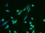 Nicastrin Antibody in Immunocytochemistry (ICC/IF)