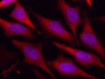 DJ-1 Antibody in Immunocytochemistry (ICC/IF)