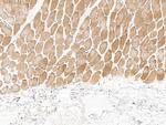 PHPT1 Antibody in Immunohistochemistry (Paraffin) (IHC (P))