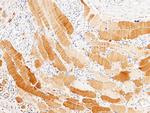 PPM1G Antibody in Immunohistochemistry (Paraffin) (IHC (P))