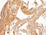 PPM1G Antibody in Immunohistochemistry (Paraffin) (IHC (P))