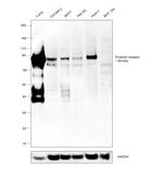 Prolactin Receptor Antibody in Western Blot (WB)