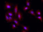 PSPH Antibody in Immunocytochemistry (ICC/IF)