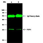 PSPH Antibody in Immunoprecipitation (IP)