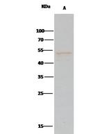 PTP1B Antibody in Immunoprecipitation (IP)