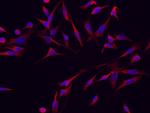 RRM1 Antibody in Immunocytochemistry (ICC/IF)