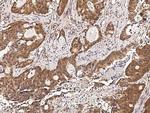 RUVBL1 Antibody in Immunohistochemistry (Paraffin) (IHC (P))