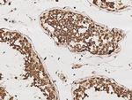 RUVBL1 Antibody in Immunohistochemistry (Paraffin) (IHC (P))