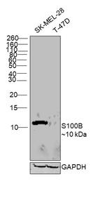 S100B Antibody in Western Blot (WB)