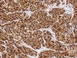 S100B Antibody in Immunohistochemistry (Paraffin) (IHC (P))