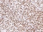 SIRT1 Antibody in Immunohistochemistry (Paraffin) (IHC (P))