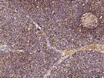 SOD2 Antibody in Immunohistochemistry (Paraffin) (IHC (P))