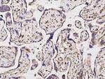 SOD2 Antibody in Immunohistochemistry (Paraffin) (IHC (P))