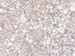 Osteopontin Antibody in Immunohistochemistry (Paraffin) (IHC (P))