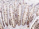 SRPK1 Antibody in Immunohistochemistry (Paraffin) (IHC (P))