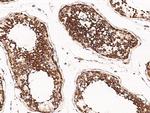 SRPK1 Antibody in Immunohistochemistry (Paraffin) (IHC (P))