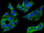 SULT1A1 Antibody in Immunocytochemistry (ICC/IF)