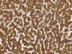 SULT1A1 Antibody in Immunohistochemistry (Paraffin) (IHC (P))