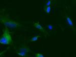 TEK Antibody in Immunocytochemistry (ICC/IF)