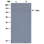 TPH1 Antibody in Immunoprecipitation (IP)