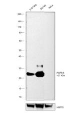 PGP9.5 Antibody in Western Blot (WB)